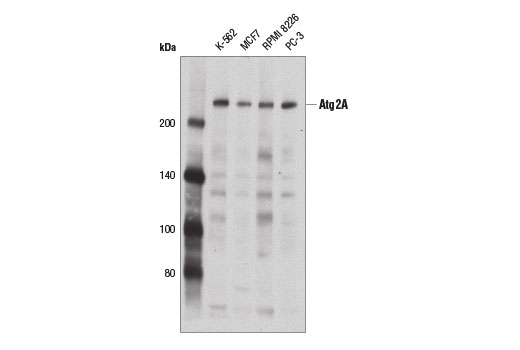 Western Blotting Image 1: Atg2A Antibody