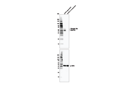  Image 1: Phospho-Tau Family Antibody Sampler Kit