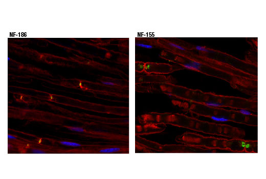 Immunofluorescence Image 1: Neurofascin 186 (D6G6O) Rabbit mAb