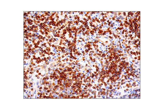 Immunohistochemistry Image 2: Bcl-2 (124) Mouse mAb