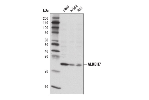 Western Blotting Image 1: ALKBH7 Antibody