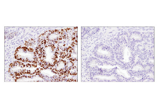 Immunohistochemistry Image 2: Aiolos (D1C1E) Rabbit mAb