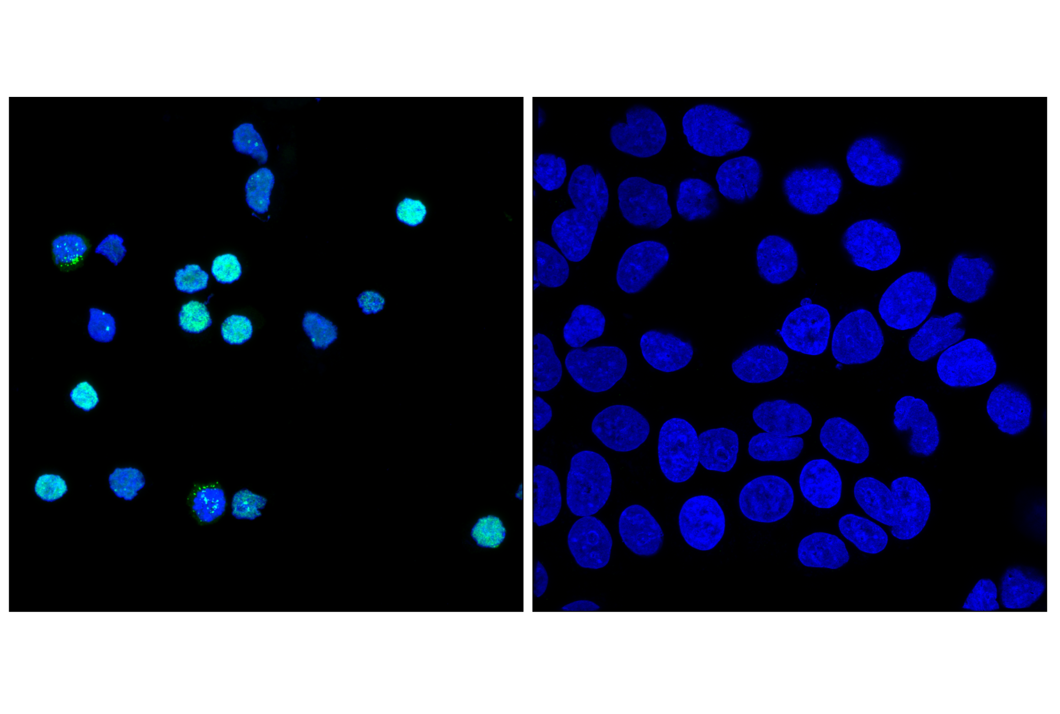 Immunofluorescence Image 1: Aiolos (D1C1E) Rabbit Monoclonal Antibody