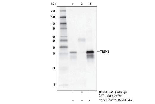 Immunoprecipitation Image 1: TREX1 (D8E2O) Rabbit mAb