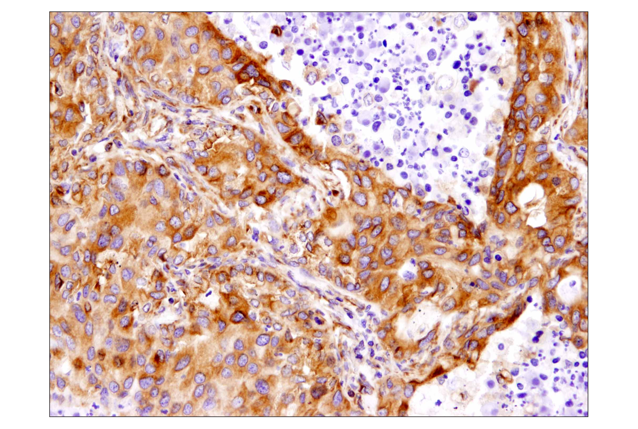 Immunohistochemistry Image 2: β-Tubulin (D2N5G) Rabbit mAb