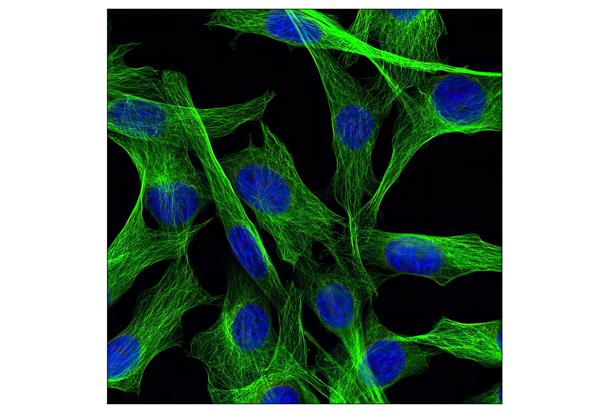 Immunofluorescence Image 1: β-Tubulin (D2N5G) Rabbit mAb