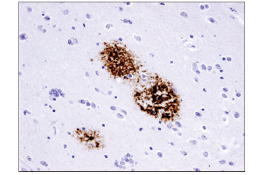 Immunohistochemistry Image 1: β-Amyloid (D3D2N) Mouse mAb