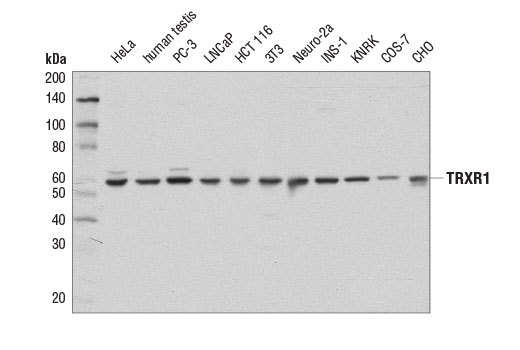  Image 4: Redox Homeostasis and Signaling Antibody Sampler Kit