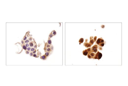  Image 19: Redox Homeostasis and Signaling Antibody Sampler Kit