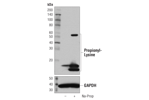 Western Blotting Image 1: Propionyl-Lysine [Prop-K] (D3A9R) Rabbit mAb
