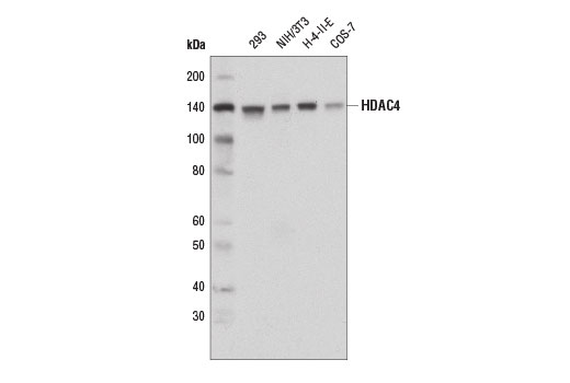  Image 1: Class II HDAC Antibody Sampler Kit