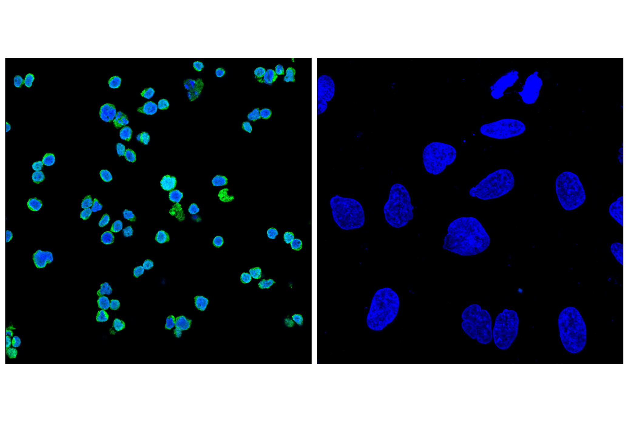 Immunofluorescence Image 1: Myeloperoxidase (E2Z8J) Rabbit mAb