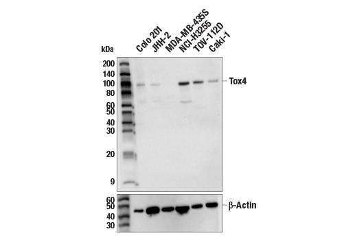 Western Blotting Image 1: Tox4 Antibody