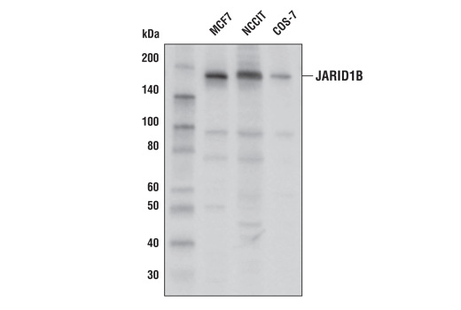  Image 1: JARID1/KDM5 Histone Demethylase Antibody Sampler Kit