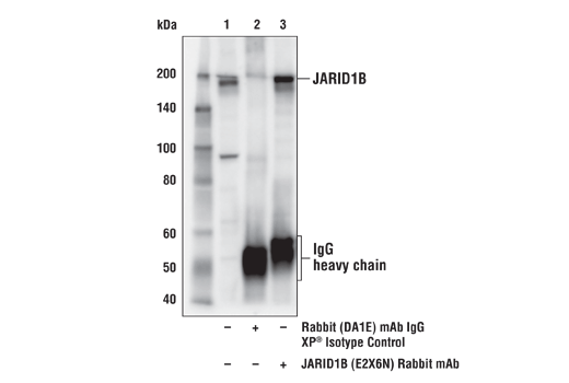  Image 7: JARID1/KDM5 Histone Demethylase Antibody Sampler Kit