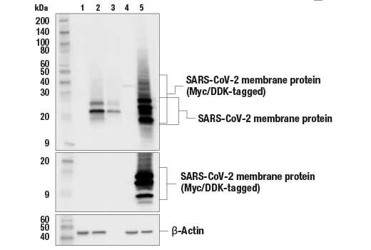 Western Blotting Image 1: SARS-CoV-2 Membrane Protein (E5A8A) Mouse mAb