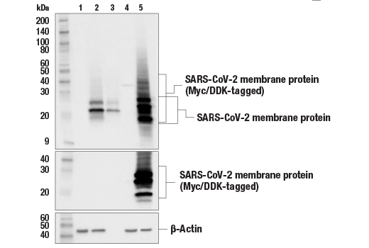 Western Blotting Image 1: SARS-CoV-2 Membrane Protein (E5A8A) Mouse mAb