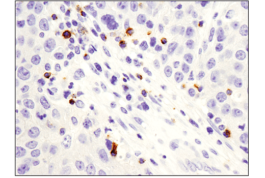  Image 16: Human Exhausted CD8+ T Cell IHC Antibody Sampler Kit