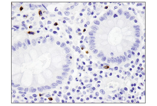  Image 32: Human Exhausted CD8+ T Cell IHC Antibody Sampler Kit