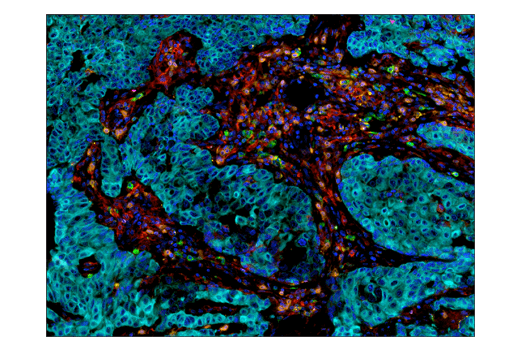  Image 51: Human Exhausted CD8+ T Cell IHC Antibody Sampler Kit