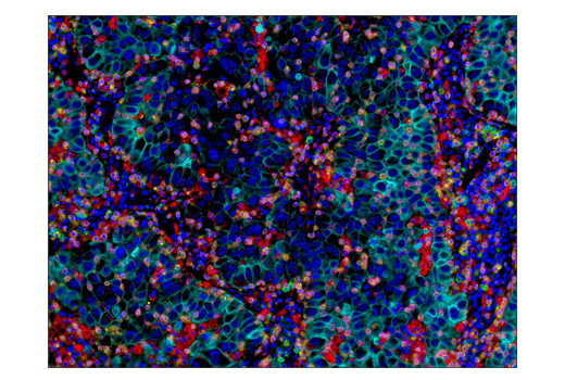  Image 50: Human Exhausted T Cell Antibody Sampler Kit