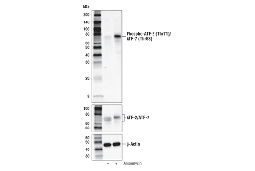  Image 2: Phospho-p38 MAPK Pathway Antibody Sampler Kit
