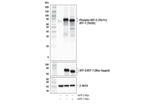 Image 9: Phospho-p38 MAPK Pathway Antibody Sampler Kit