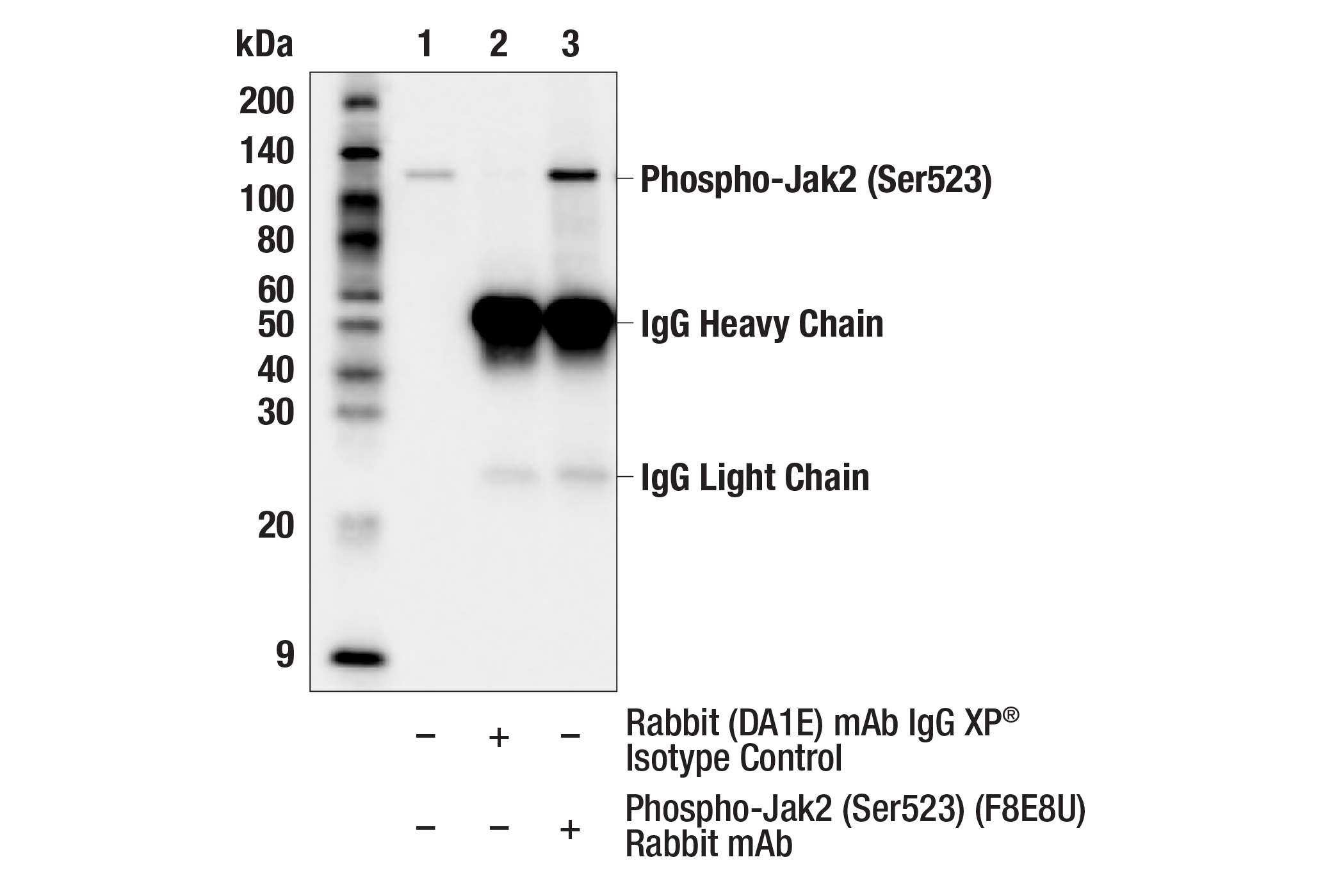 Immunoprecipitation Image 1: Phospho-Jak2 (Ser523) (F8E8U) Rabbit mAb