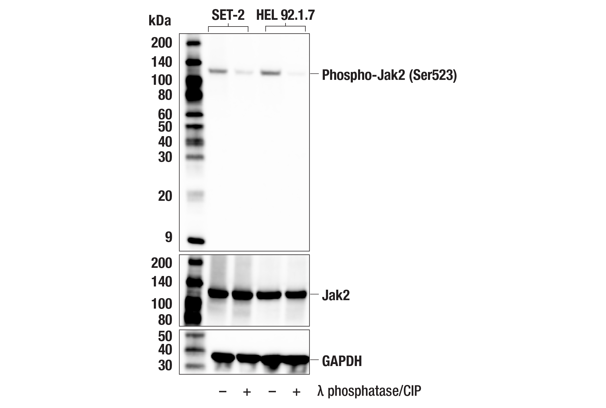 Western Blotting Image 2: Phospho-Jak2 (Ser523) (F8E8U) Rabbit mAb