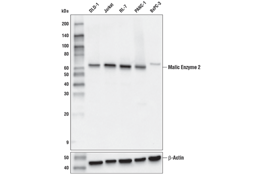 Western Blotting Image 1: Malic Enzyme 2 (E1N3E) XP® Rabbit mAb