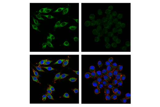 Immunofluorescence Image 1: IκBβ (D1T3Z) Rabbit mAb