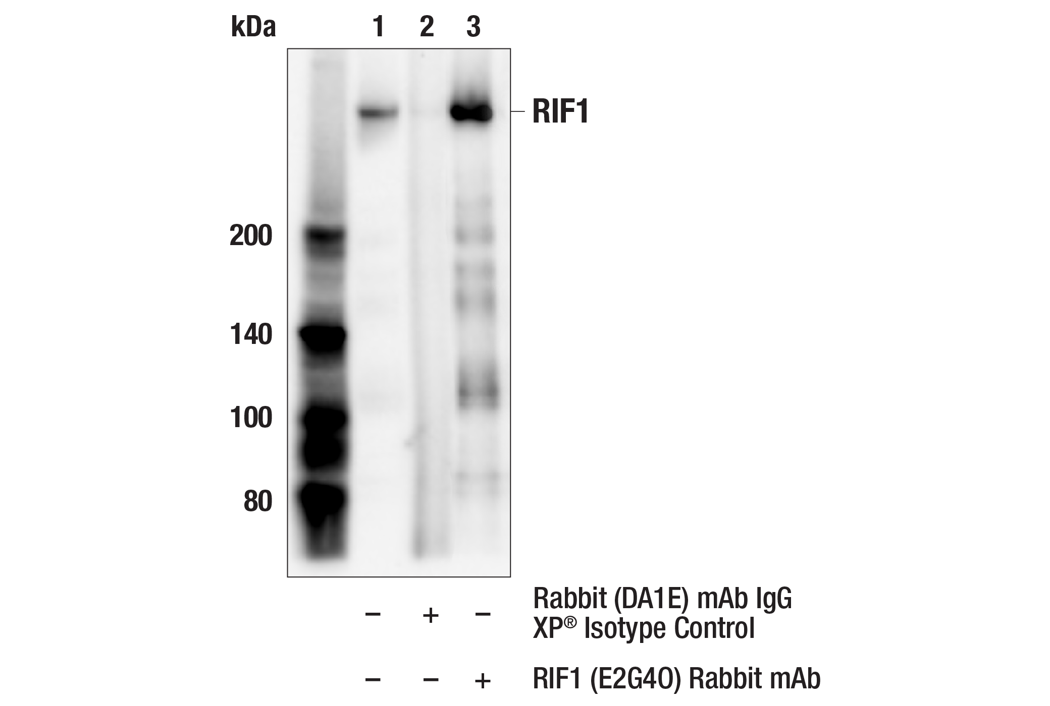 Immunoprecipitation Image 1: RIF1 (E2G4O) Rabbit mAb