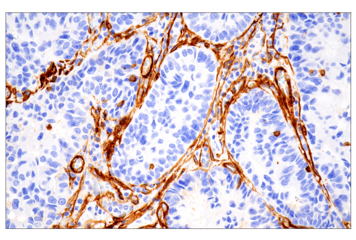 Immunohistochemistry Image 1: Integrin α1/CD49a (E9K2J) XP® Rabbit mAb