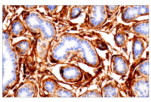 Immunohistochemistry Image 2: Integrin α1/CD49a (E9K2J) XP® Rabbit mAb