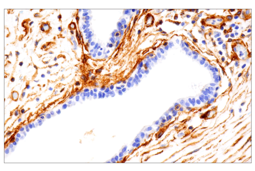Immunohistochemistry Image 4: Integrin α1/CD49a (E9K2J) XP® Rabbit mAb