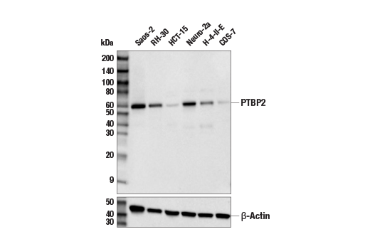 Western Blotting Image 2: PTBP2 Antibody