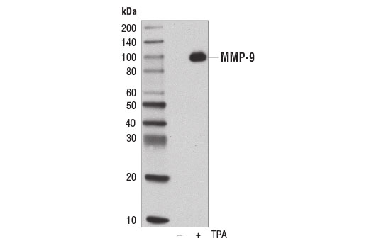 Western Blotting Image 1: MMP-9 (D6O3H) XP® Rabbit mAb (BSA and Azide Free)