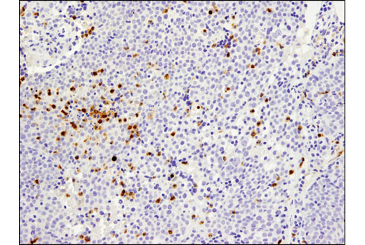 Immunohistochemistry Image 2: MMP-9 (D6O3H) XP® Rabbit mAb (BSA and Azide Free)