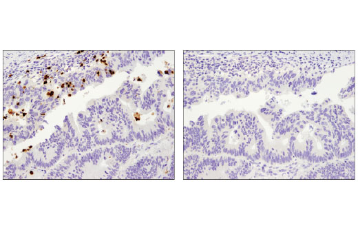 Immunohistochemistry Image 3: MMP-9 (D6O3H) XP® Rabbit mAb (BSA and Azide Free)