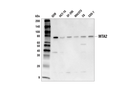 Western Blotting Image 1: MTA2 Antibody