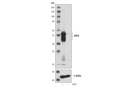  Image 5: PhosphoPlus® RIP3 (Thr231/Ser232) Antibody Duet