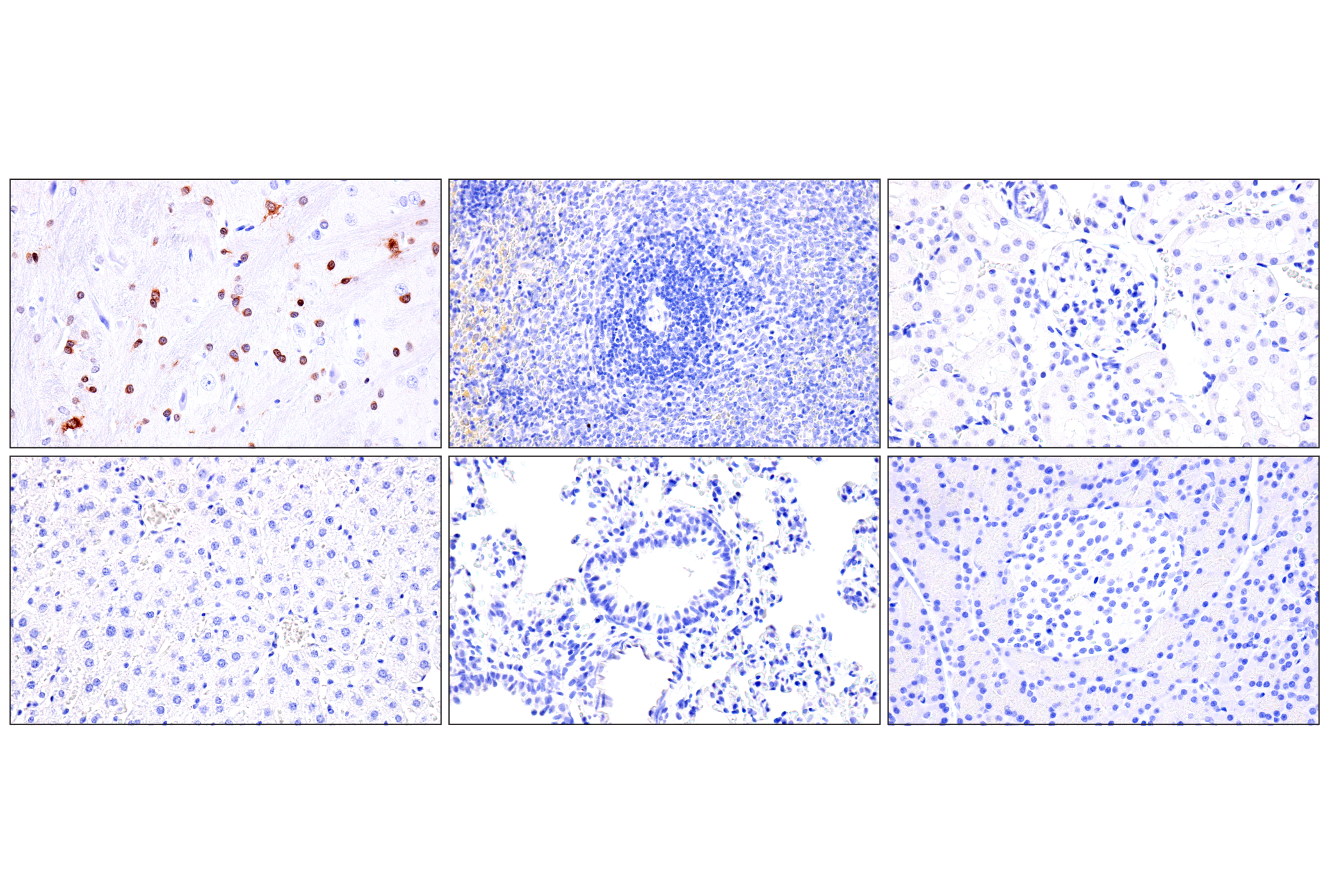 Immunohistochemistry Image 5: Olig1 (E3T6D) Rabbit mAb