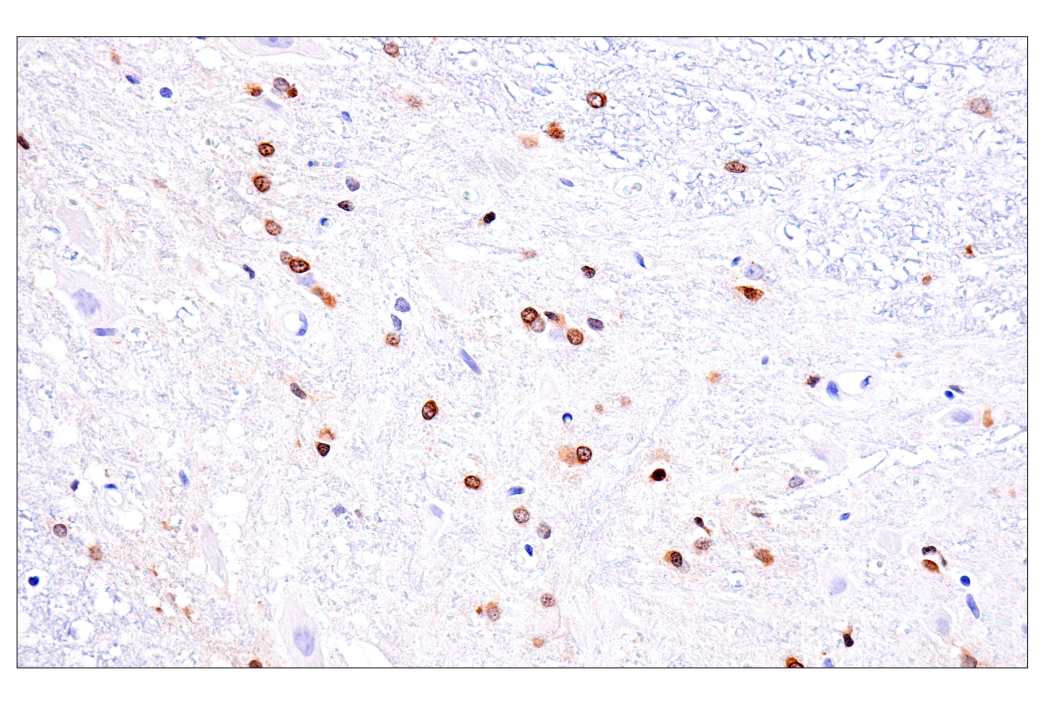 Immunohistochemistry Image 4: Olig1 (E3T6D) Rabbit mAb