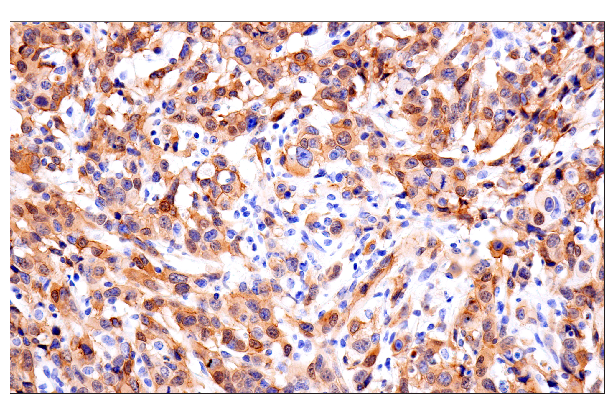 Immunohistochemistry Image 3: Olig1 (E3T6D) Rabbit mAb