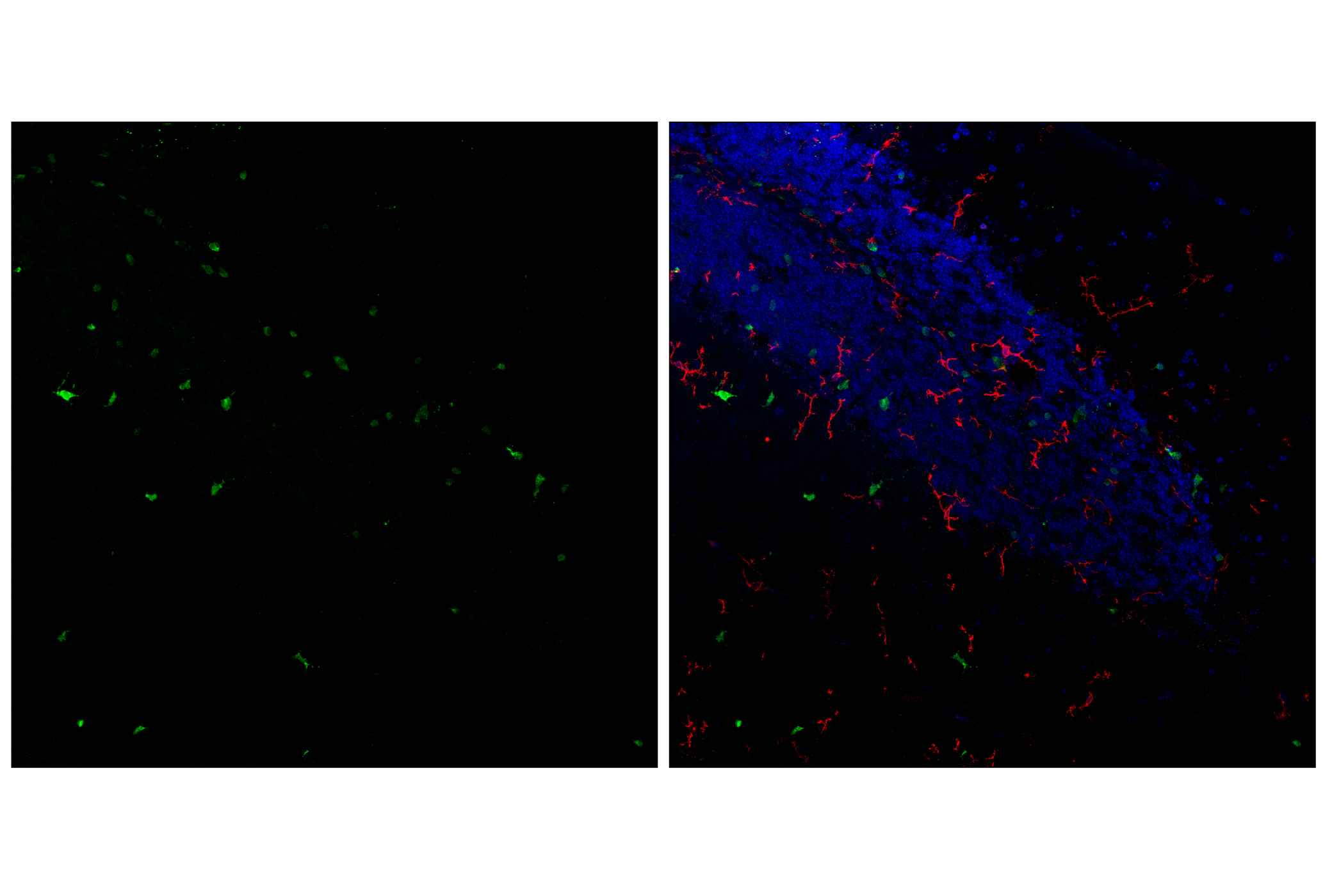 Immunofluorescence Image 1: Olig1 (E3T6D) Rabbit mAb