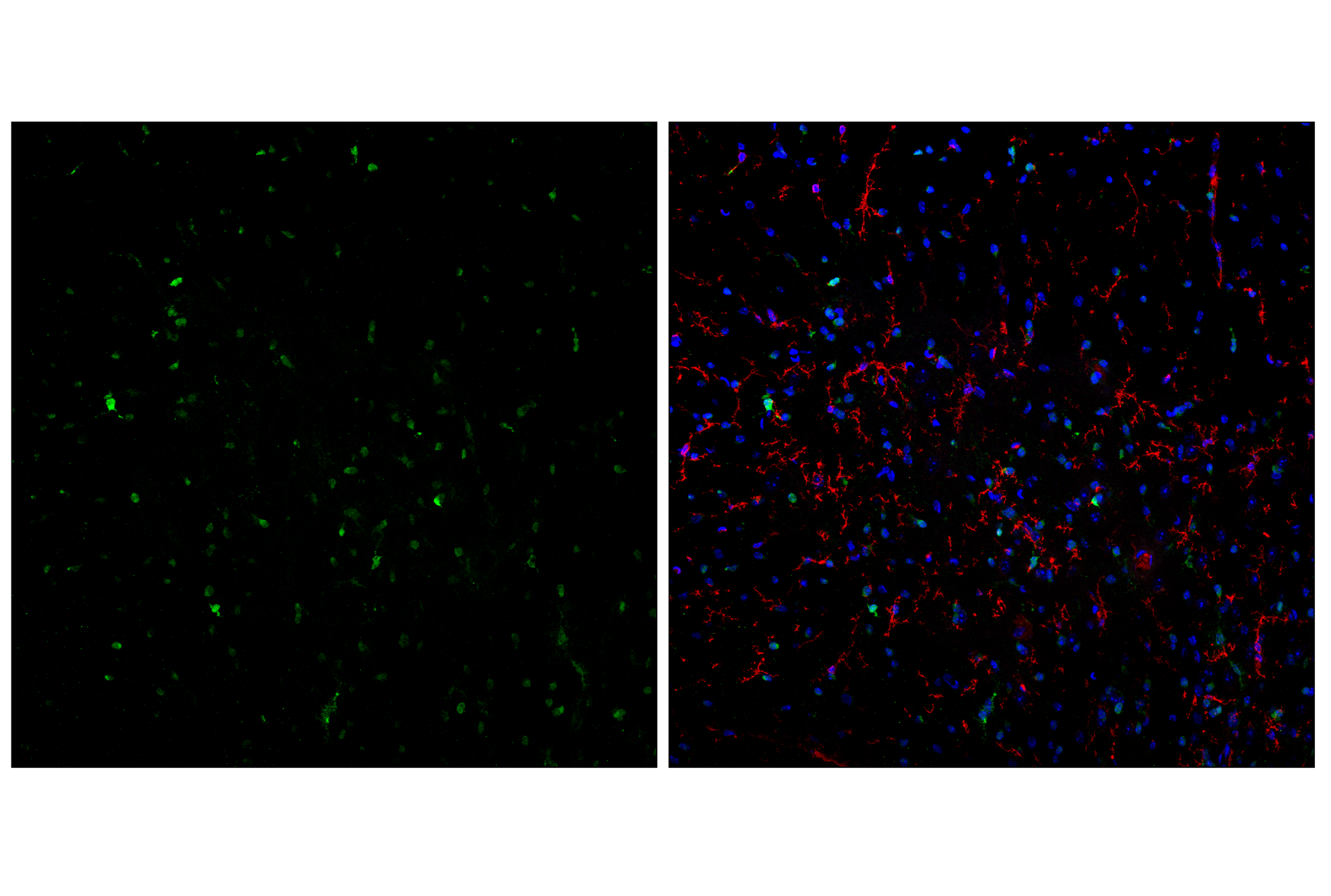 Immunofluorescence Image 2: Olig1 (E3T6D) Rabbit mAb