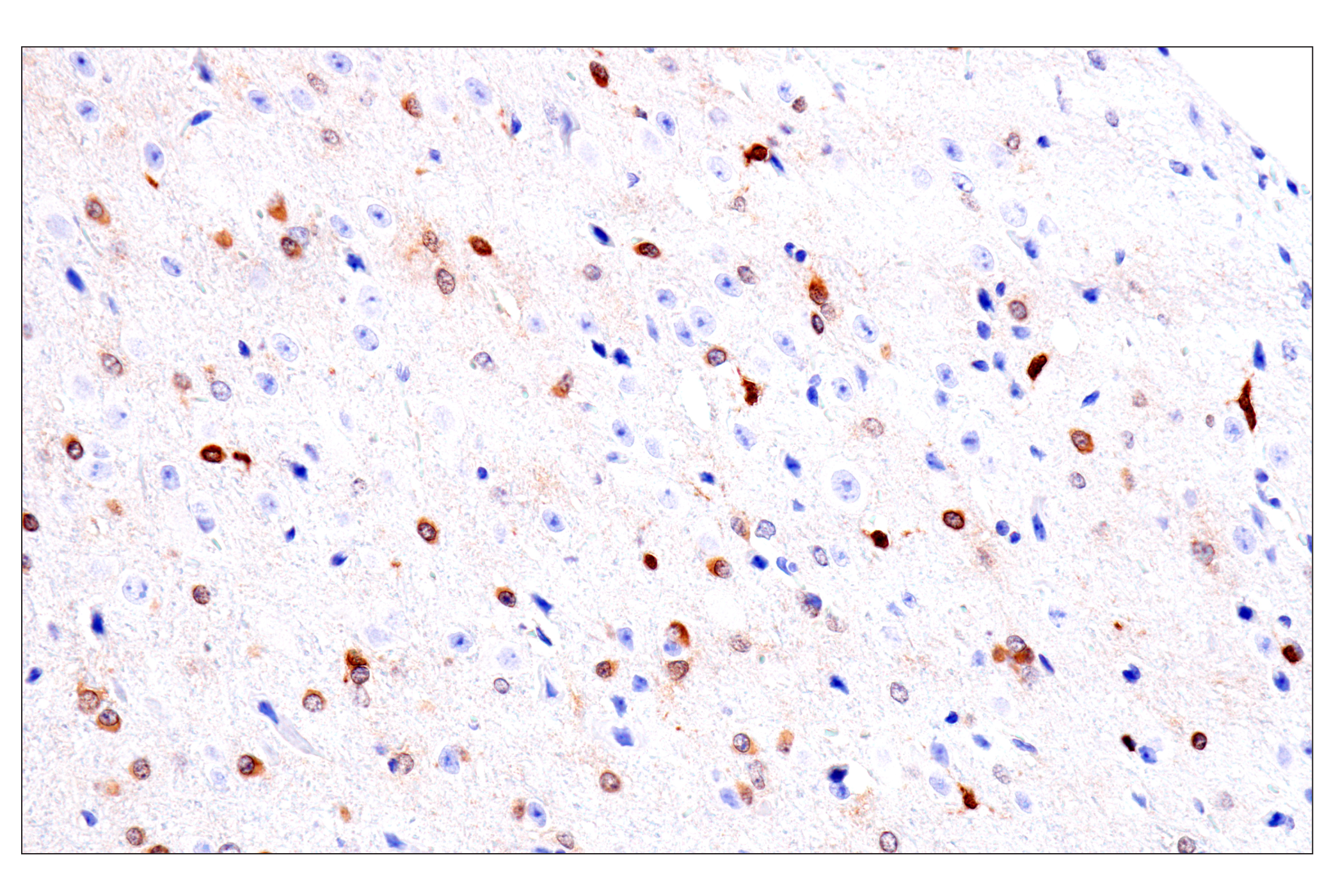 Immunohistochemistry Image 2: Olig1 (E3T6D) Rabbit mAb