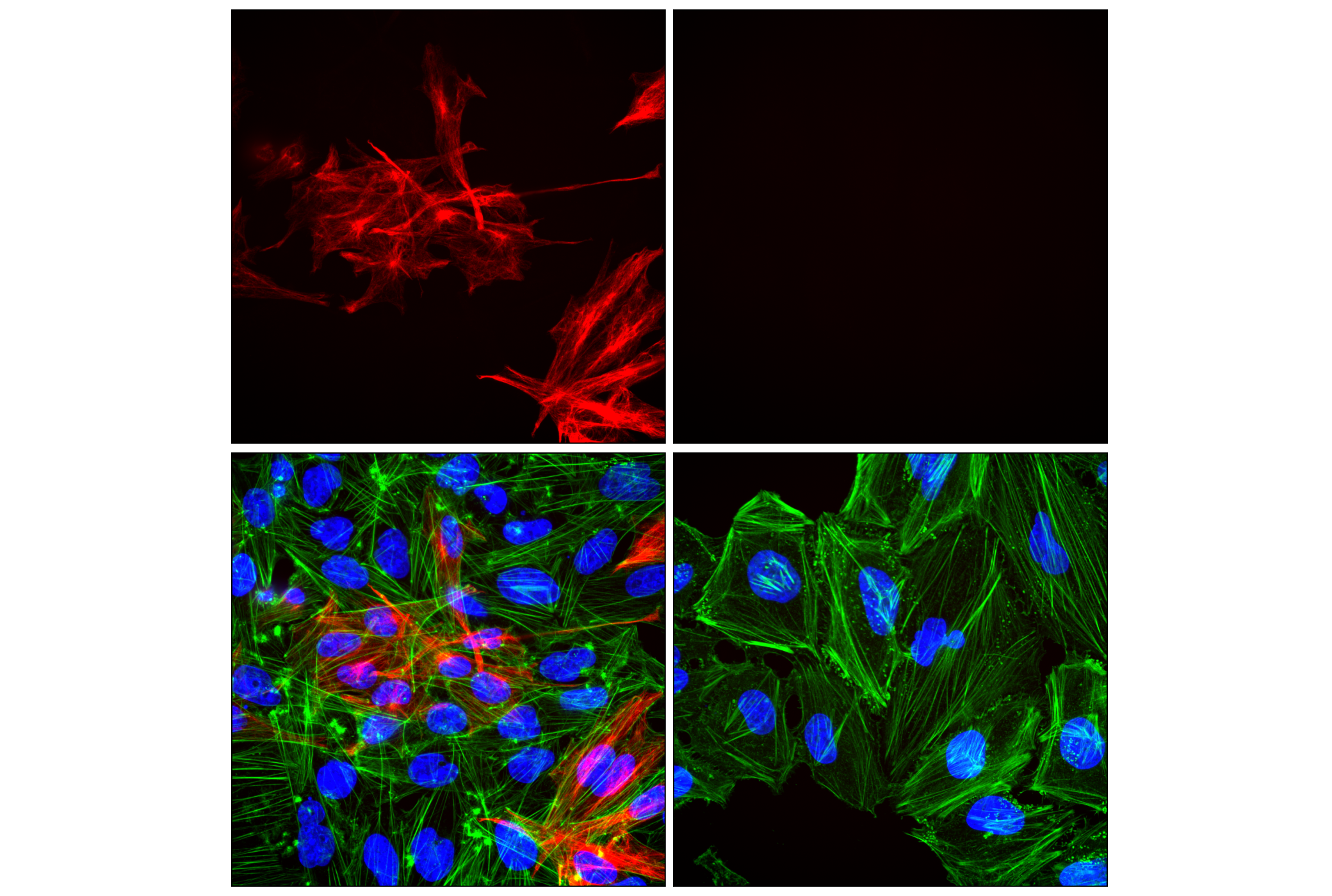 Immunofluorescence Image 2: GFAP (E4L7M) XP® Rabbit mAb (Alexa Fluor® 647 Conjugate)