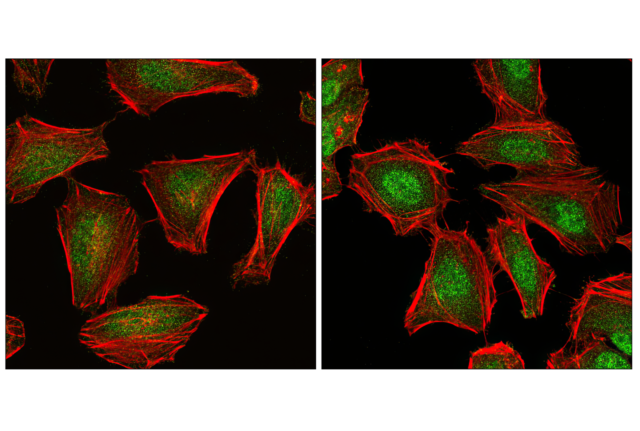 Immunofluorescence Image 1: Phospho-SAPK/JNK (Thr183/Tyr185) (G9) Mouse mAb (BSA and Azide Free)