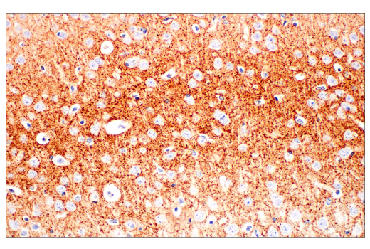 Immunohistochemistry Image 1: VGLUT2 (E2V4W) Rabbit mAb